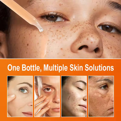 Vitamin C Brightening Serum 30ml – Dark Spot Remover & Glow Booster | Shaqtu™